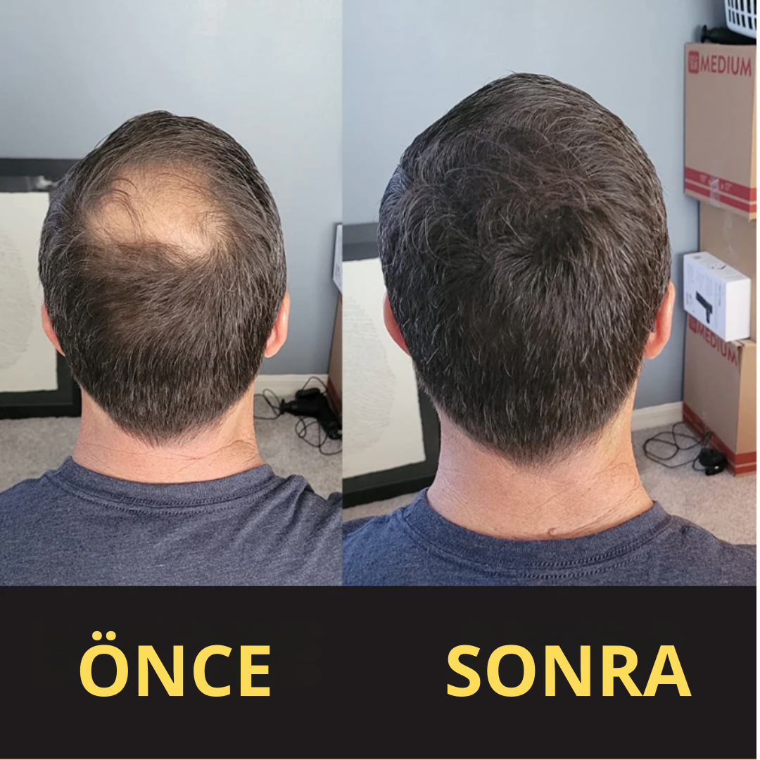 HairFillUp Siyah Saç Kapatıcı – 50 ml