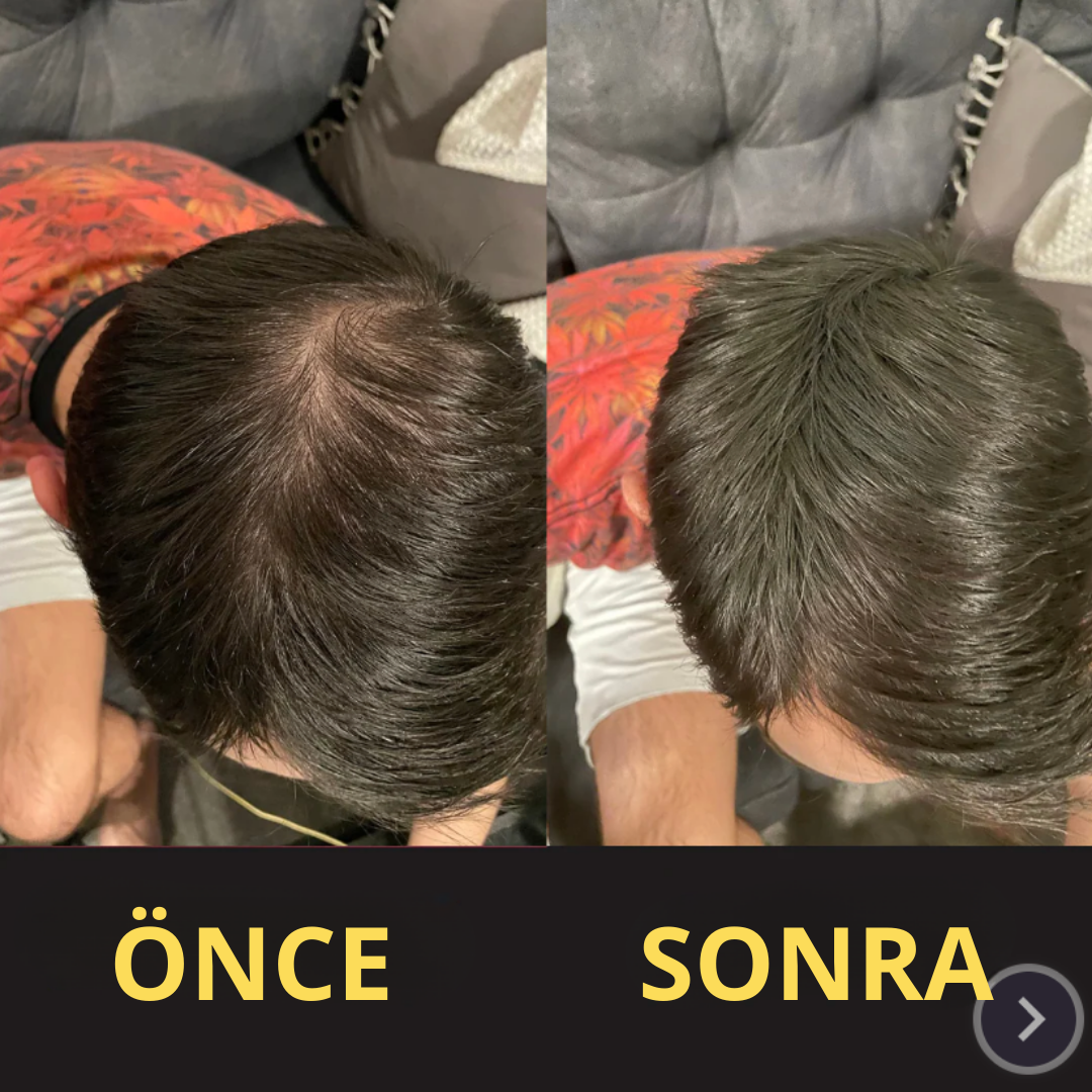 HairFillUp Siyah Saç Kapatıcı – 50 ml