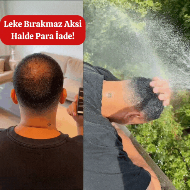 HairFillUp Siyah Saç Kapatıcı – 50 ml